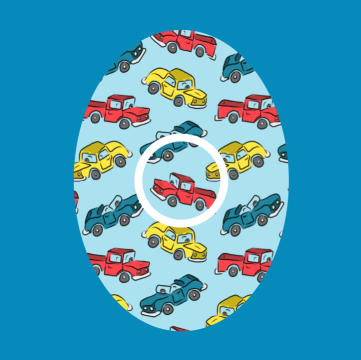 CAR & TRUCKS  - INFUSION SET OVERLAY